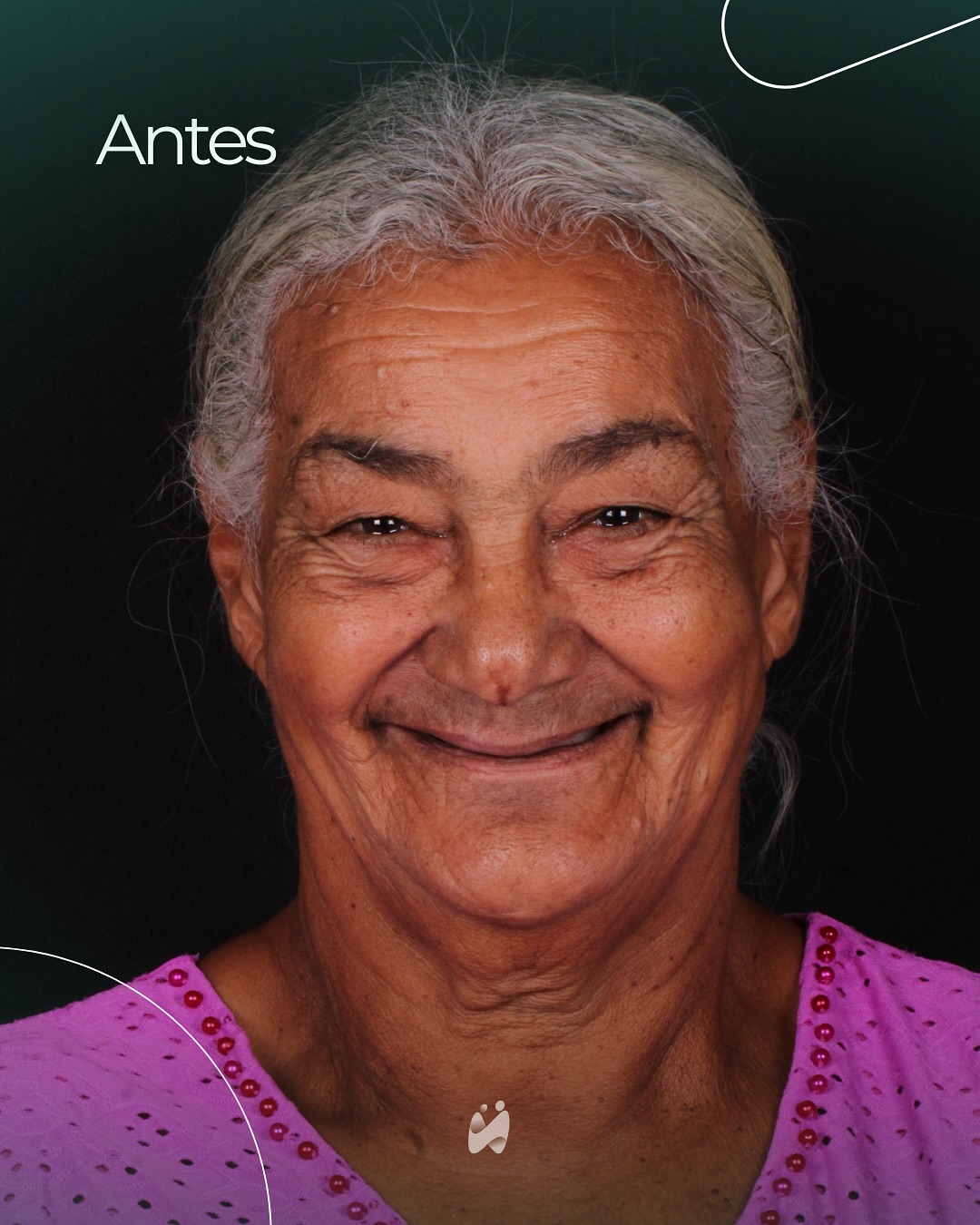 Caso 3 — antes