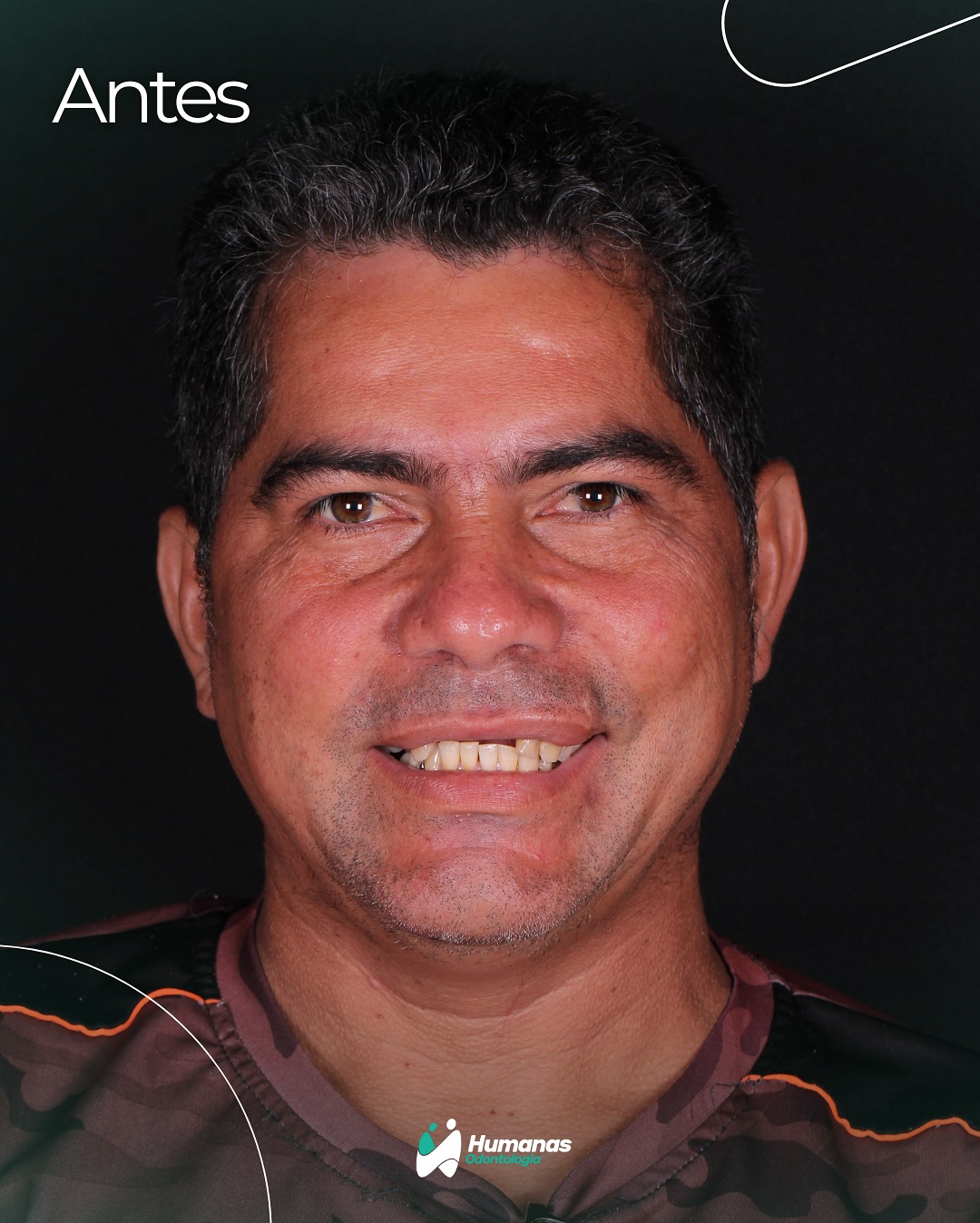 Caso 2 — antes